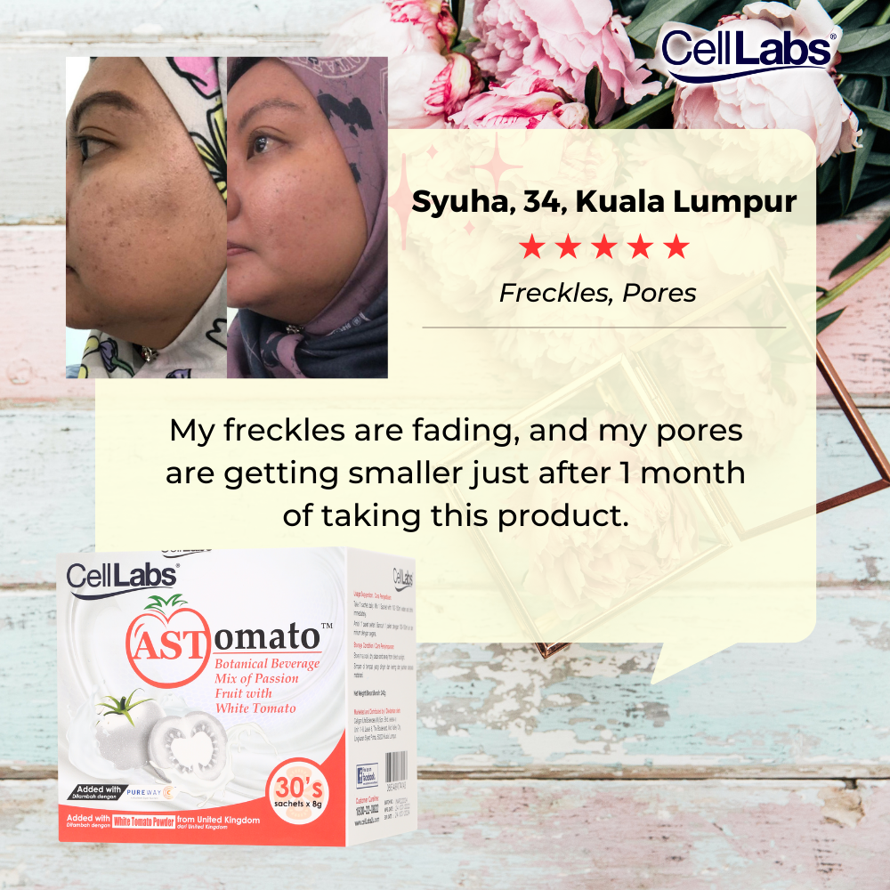 1.-CellLabs-ASTomato-Review-Syuha